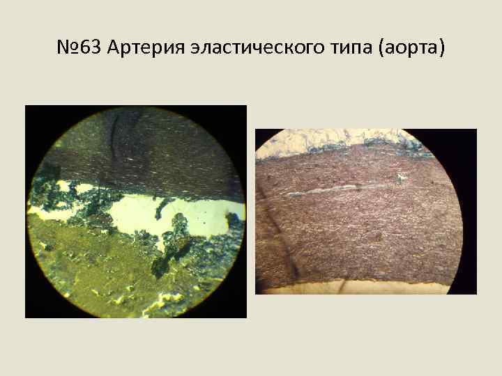 № 63 Артерия эластического типа (аорта) 