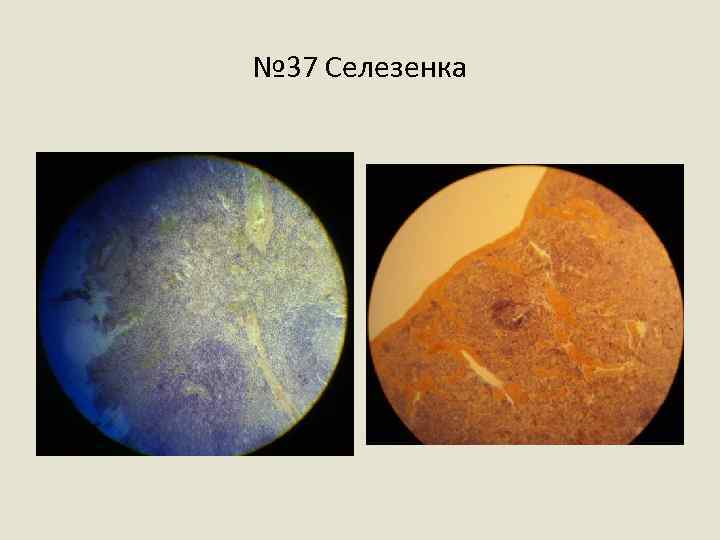 № 37 Селезенка 