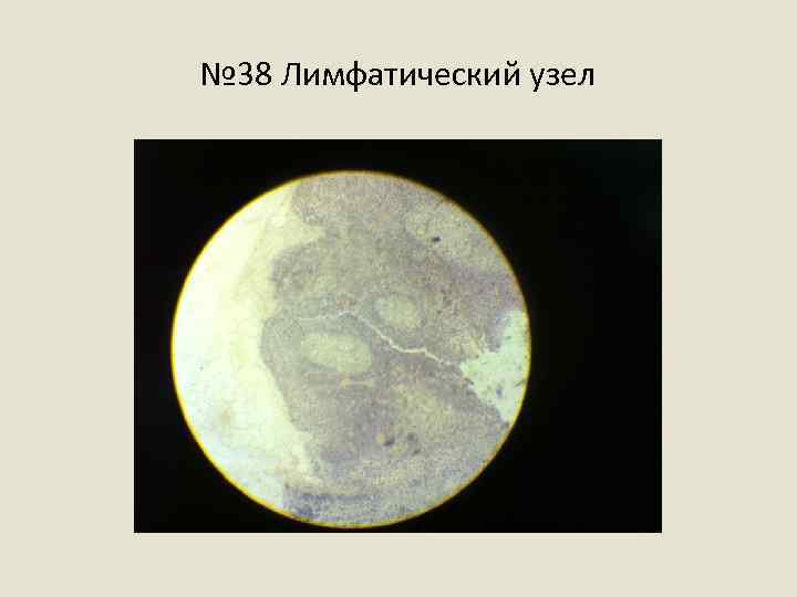 № 38 Лимфатический узел 