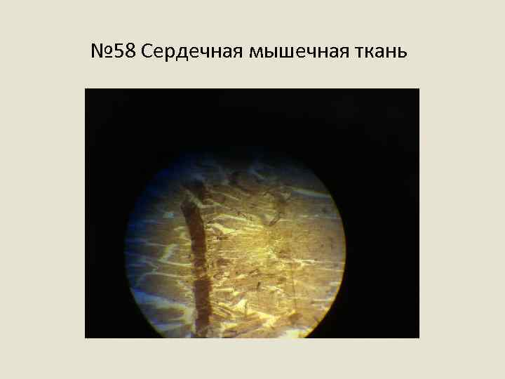 № 58 Сердечная мышечная ткань 