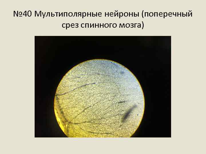 № 40 Мультиполярные нейроны (поперечный срез спинного мозга) 