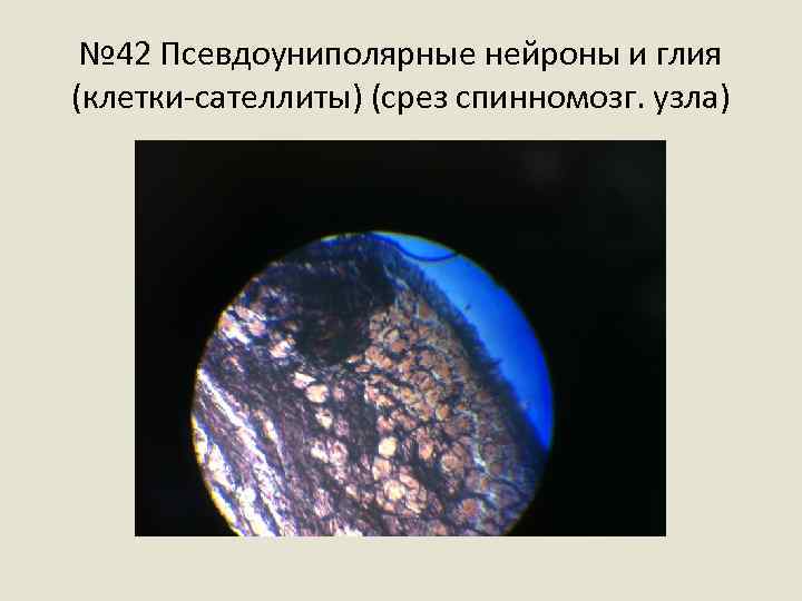 № 42 Псевдоуниполярные нейроны и глия (клетки-сателлиты) (срез спинномозг. узла) 