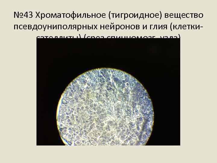 № 43 Хроматофильное (тигроидное) вещество псевдоуниполярных нейронов и глия (клеткисателлиты) (срез спинномозг. узла) 