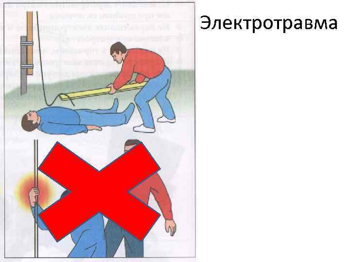 Электротравма 