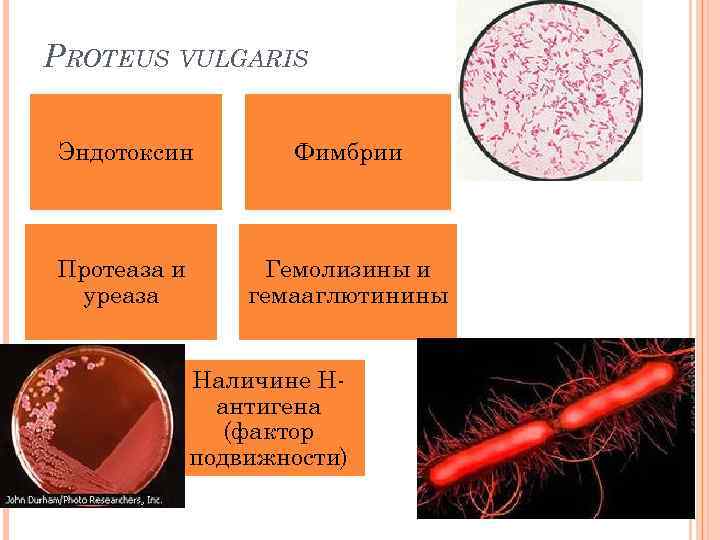 PROTEUS VULGARIS Эндотоксин Фимбрии Протеаза и уреаза Гемолизины и гемааглютинины Наличине Нантигена (фактор подвижности)