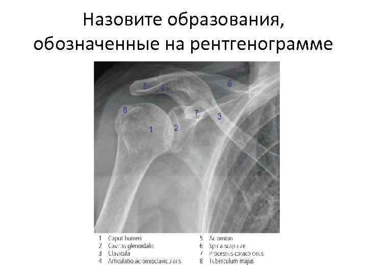 Назовите образования, обозначенные на рентгенограмме 