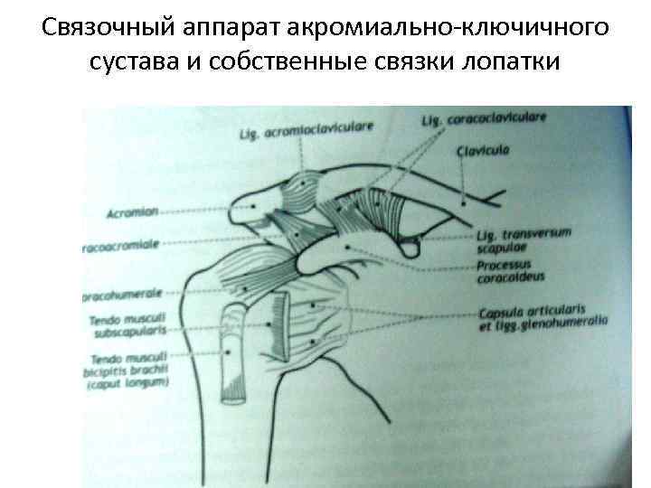 Акромиально ключичное сочленение