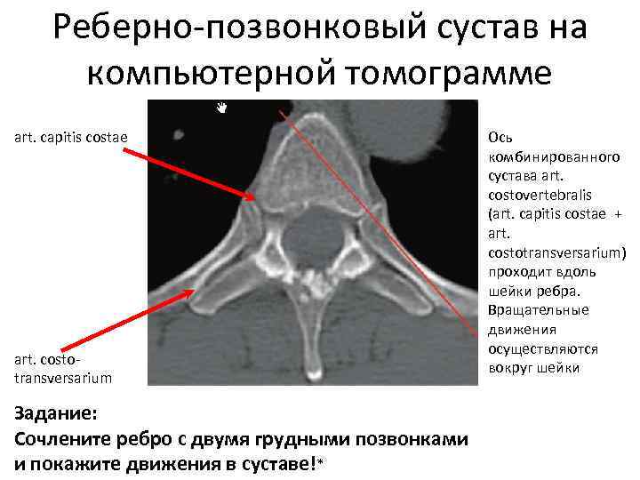 Реберно позвоночный сустав