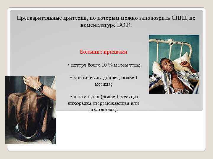 Предварительные критерии, по которым можно заподозрить СПИД по номенклатуре ВОЗ): Большие признаки • потеря