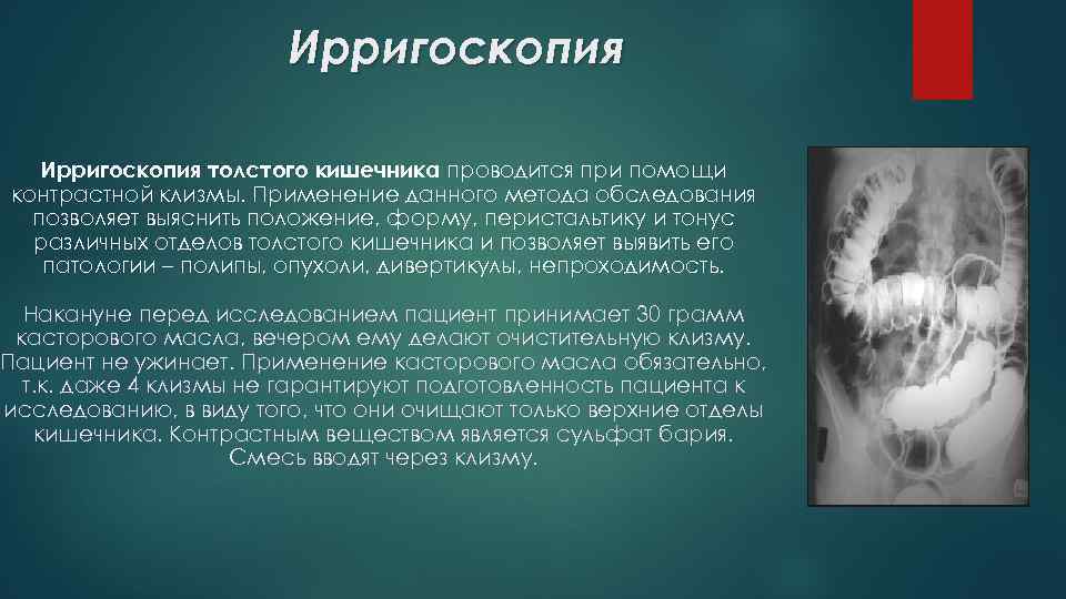 Ирригоскопия это рентгенологическое контрастное исследование. Ирригоскопия контрастное вещество. Ирригоскопия Толстого кишечника. Ирригоскопия применяется для исследования. Ирригоскопия заключение.