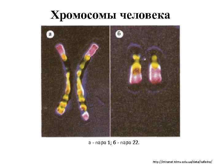 Хромосомы человека а - пара 1; б - пара 22. http: //intranet. tdmu. edu.