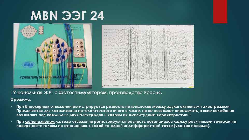 MBN ЭЭГ 24 19 -канальная ЭЭГ с фотостимулятором, производство Россия. 2 режима: • При