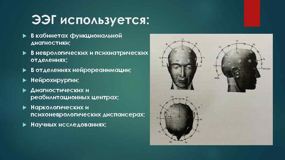 ЭЭГ используется: В кабинетах функциональной диагностики; В неврологических и психиатрических отделениях; В отделениях нейрореанимации;