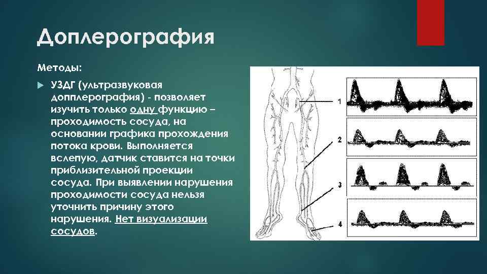 Доплерография Методы: УЗДГ (ультразвуковая допплерография) - позволяет изучить только одну функцию – проходимость сосуда,