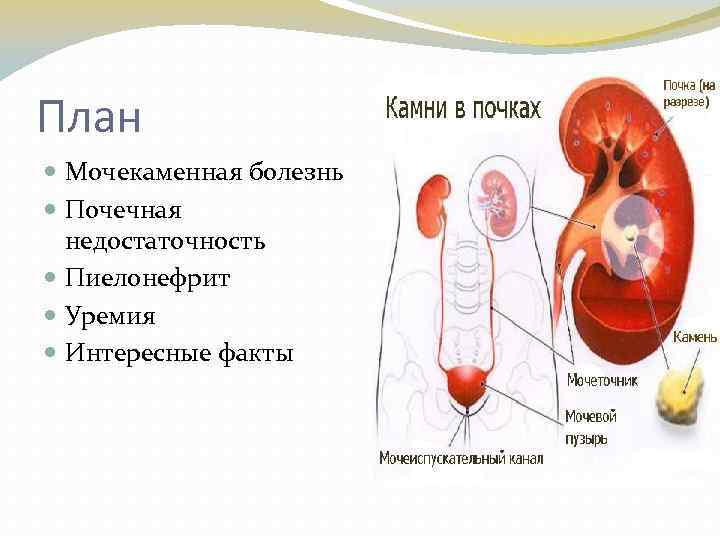 План Мочекаменная болезнь Почечная недостаточность Пиелонефрит Уремия Интересные факты 