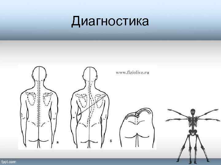 Диагностика 