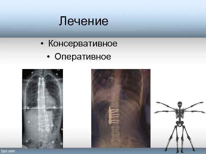 Лечение • Консервативное • Оперативное 