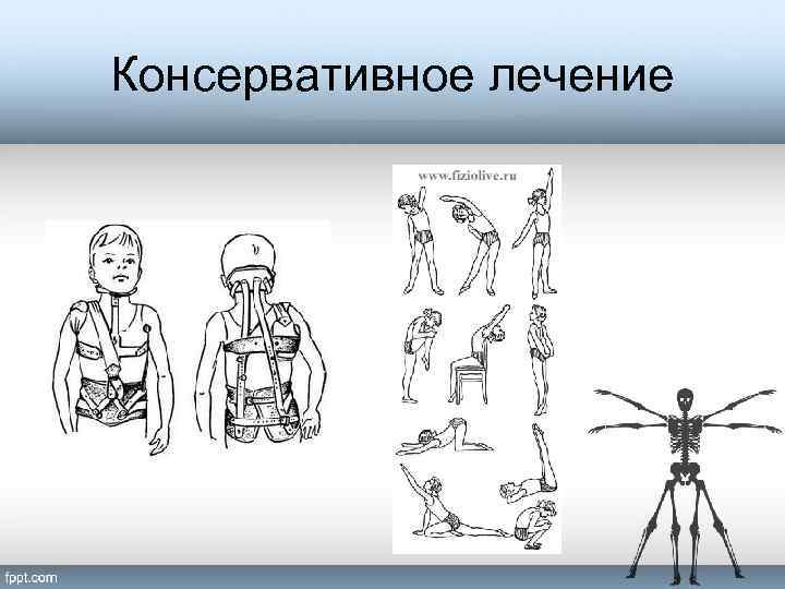 Консервативное лечение 