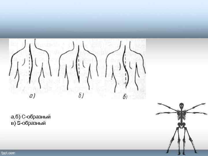 а, б) С-образный в) S-образный 