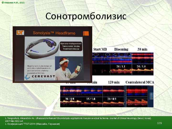 © Алашеев А. М. , 2015 Сонотромболизис 1. Tsivgoulis G, Alexandrov AV. Ultrasound enhanced