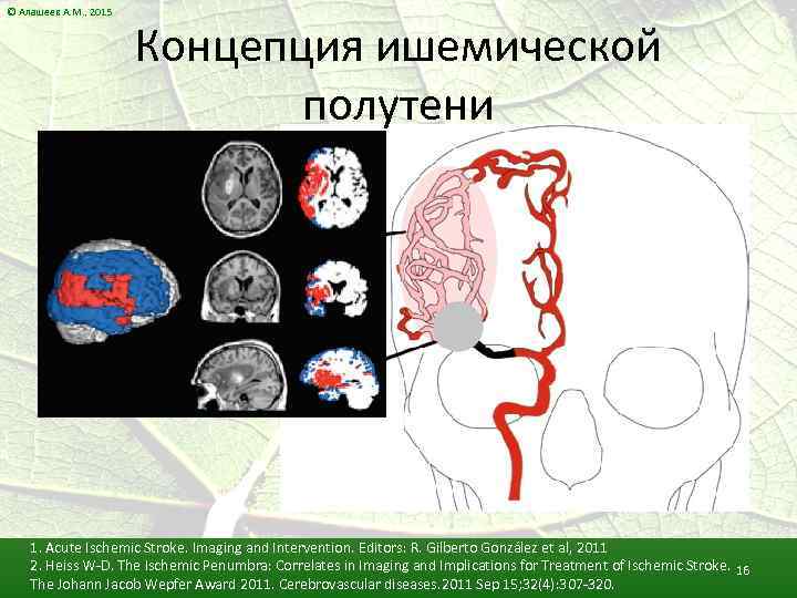 © Алашеев А. М. , 2015 Концепция ишемической полутени 1. Acute Ischemic Stroke. Imaging