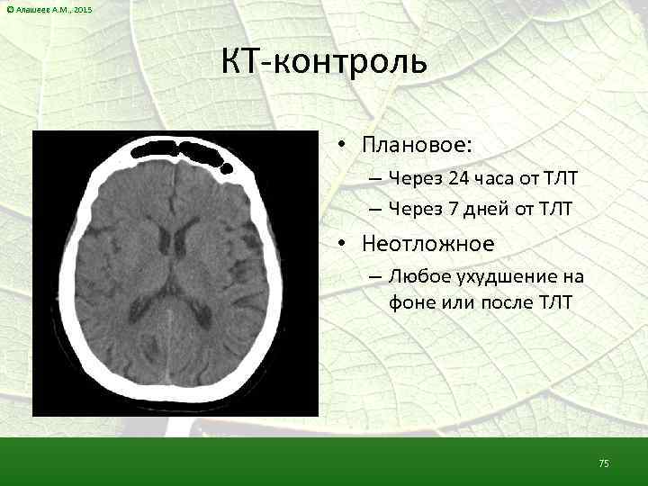 © Алашеев А. М. , 2015 КТ-контроль • Плановое: – Через 24 часа от