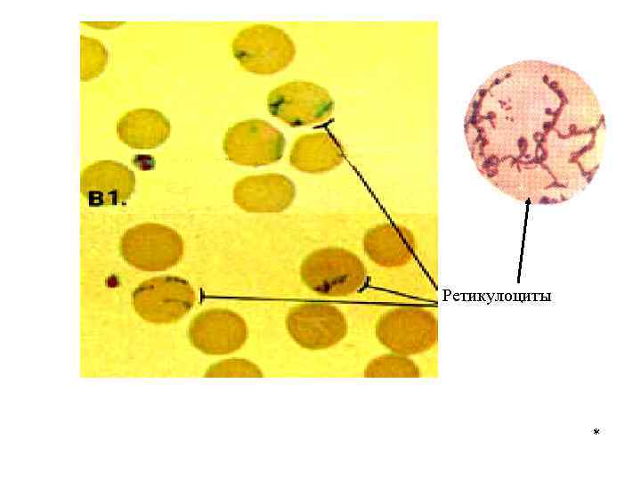 Ретикулоциты * 
