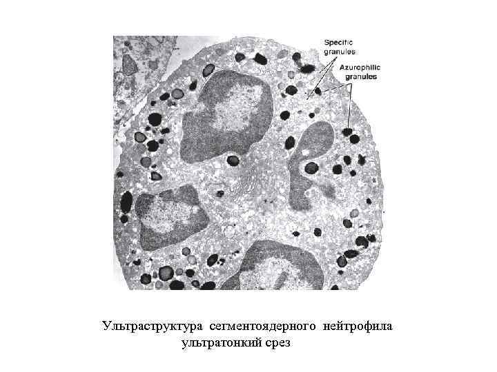 Ультраструктура сегментоядерного нейтрофила ультратонкий срез 