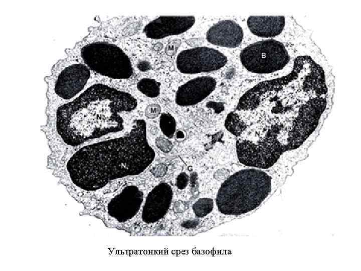 На мазке крови Ультратонкий срез базофила 