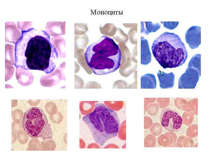Моноциты 