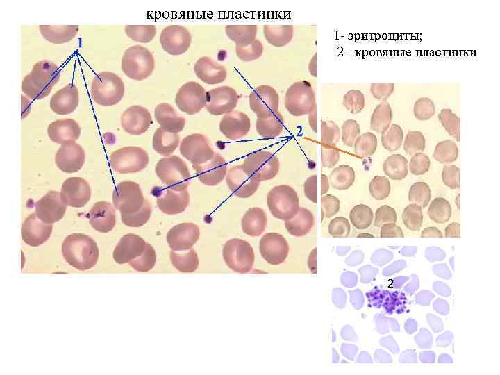 кровяные пластинки 1 - эритроциты; 2 - кровяные пластинки 2 