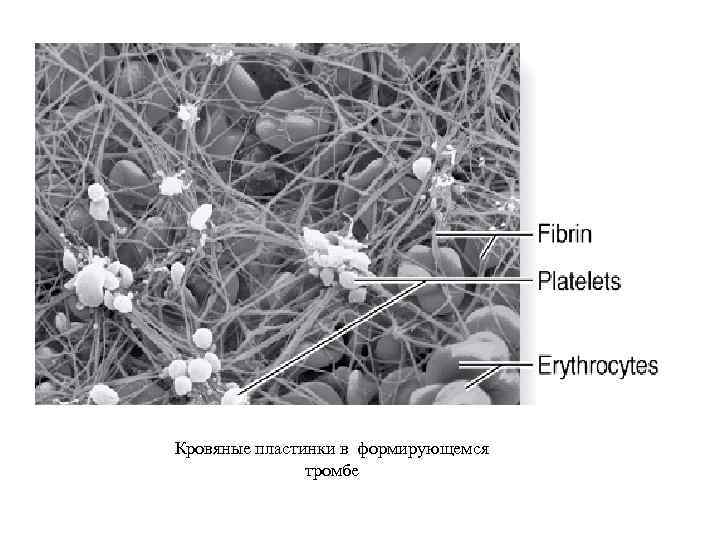 Кровяные пластинки в формирующемся тромбе 