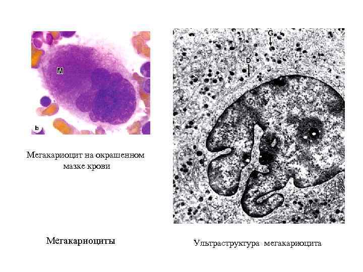 Мегакариоцит на окрашенном мазке крови Мегакариоциты Ультраструктура мегакариоцита 