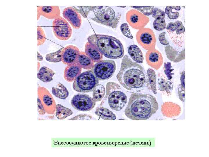 Внесосудистое кроветворение (печень) 