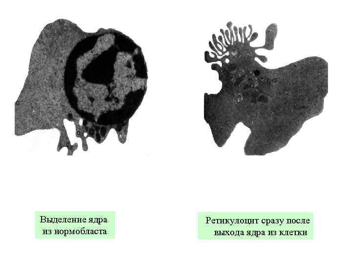 Выделение ядра из нормобласта Ретикулоцит сразу после выхода ядра из клетки 