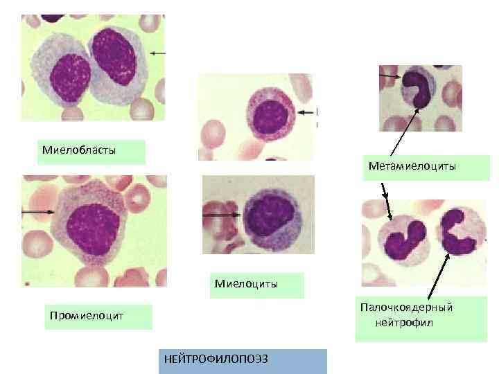 Миелоцит фото под микроскопом