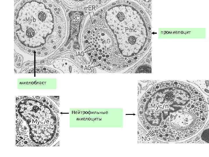 промиелоцит миелобласт Нейтрофильные миелоциты 