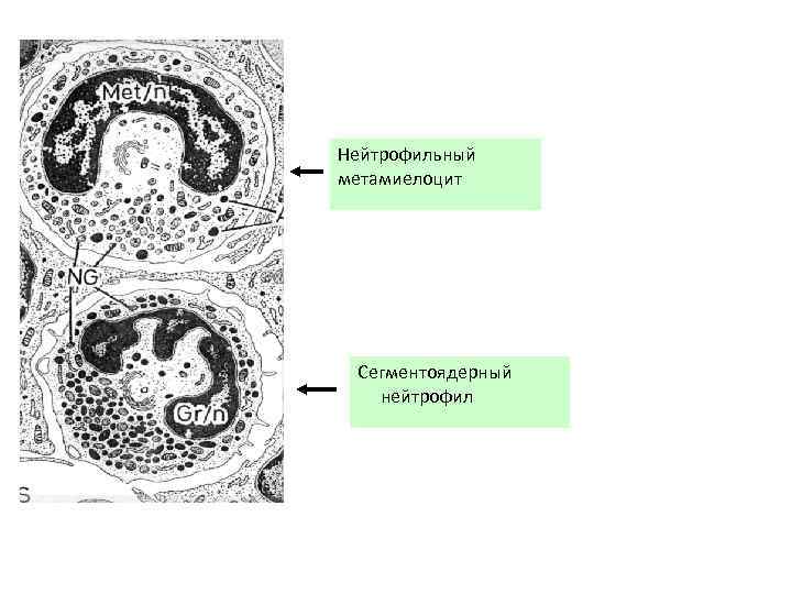 Нейтрофильный метамиелоцит Сегментоядерный нейтрофил 