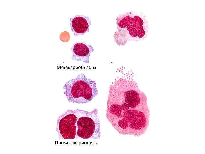 Мегакариобласты Промегакариоциты 