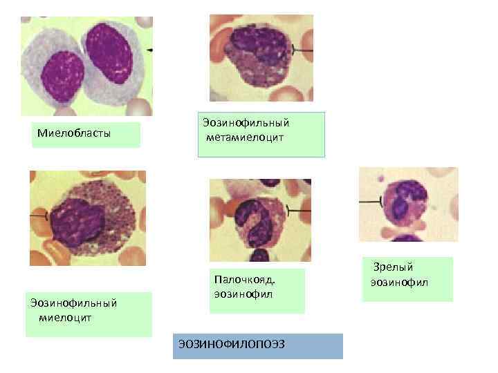 Миелоцит фото под микроскопом