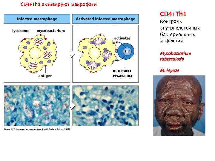 CD 4+Th 1 активируют макрофаги CD 4+Th 1 Контроль внутриклеточных бактериальных инфекций Mycobacterium tuberculosis