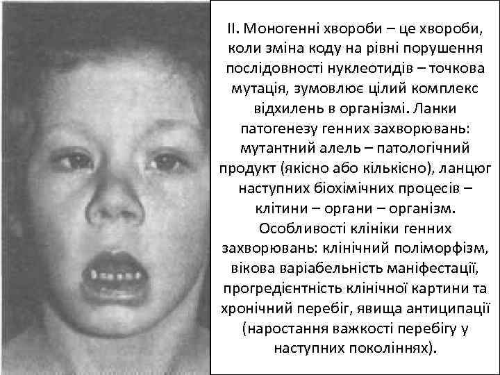 ІІ. Моногенні хвороби – це хвороби, коли зміна коду на рівні порушення послідовності нуклеотидів