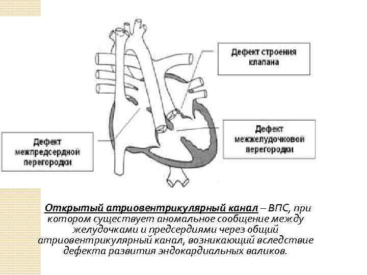 Для аускультативной картины дмпп характерно