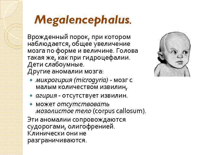 Megalencephalus. Врожденный порок, при котором наблюдается, общее увеличение мозга по форме и величине. Голова