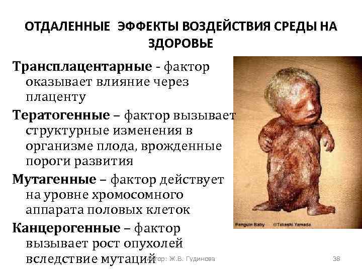 ОТДАЛЕННЫЕ ЭФФЕКТЫ ВОЗДЕЙСТВИЯ СРЕДЫ НА ЗДОРОВЬЕ Трансплацентарные - фактор оказывает влияние через плаценту Тератогенные