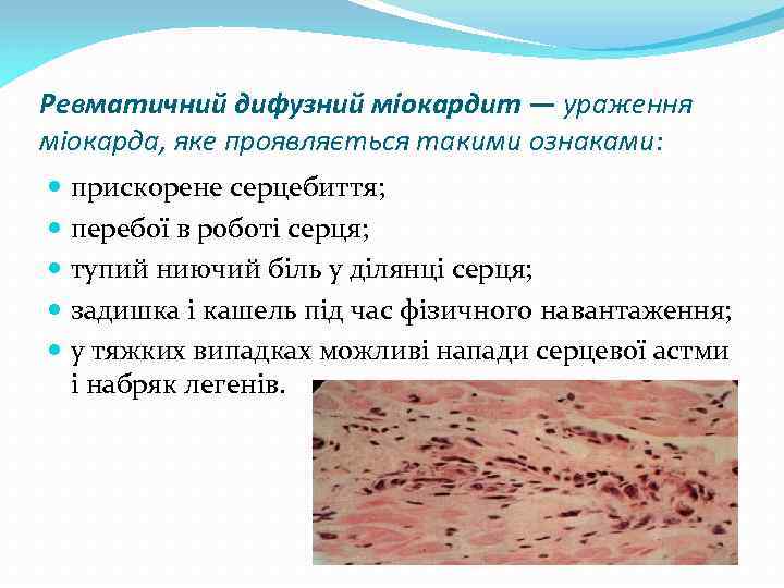 Ревматичний дифузний міокардит — ураження міокарда, яке проявляється такими ознаками: прискорене серцебиття; перебої в