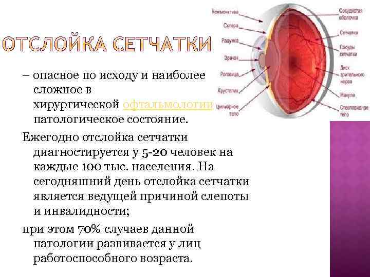 – опасное по исходу и наиболее сложное в хирургической офтальмологии патологическое состояние. Ежегодно отслойка