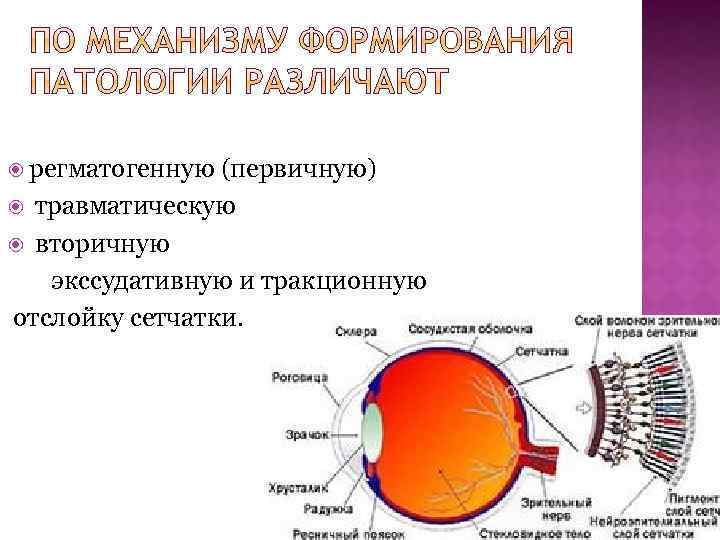  регматогенную (первичную) травматическую вторичную экссудативную и тракционную отслойку сетчатки. 