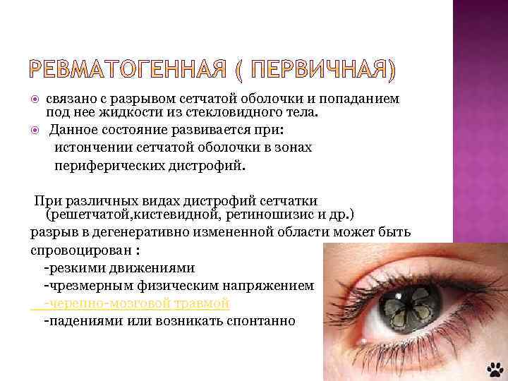 связано с разрывом сетчатой оболочки и попаданием под нее жидкости из стекловидного тела. Данное