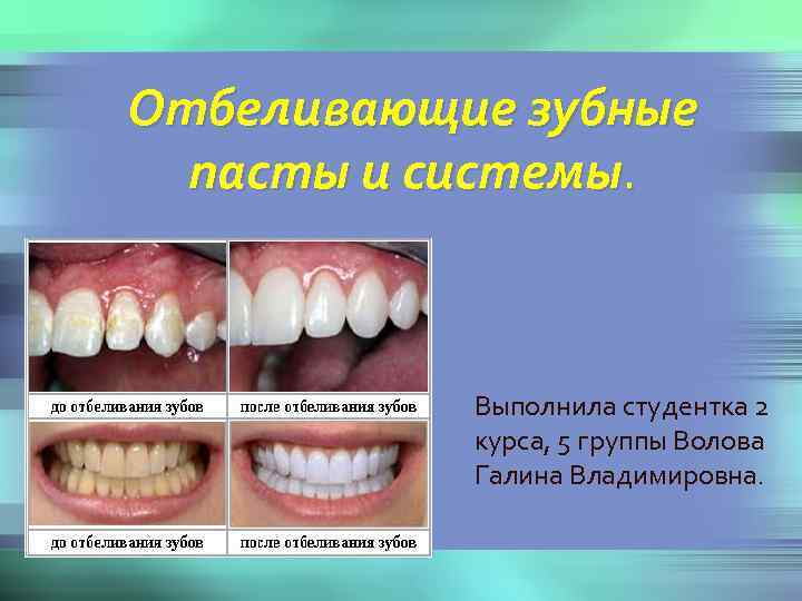 презентация отбеливания зубов